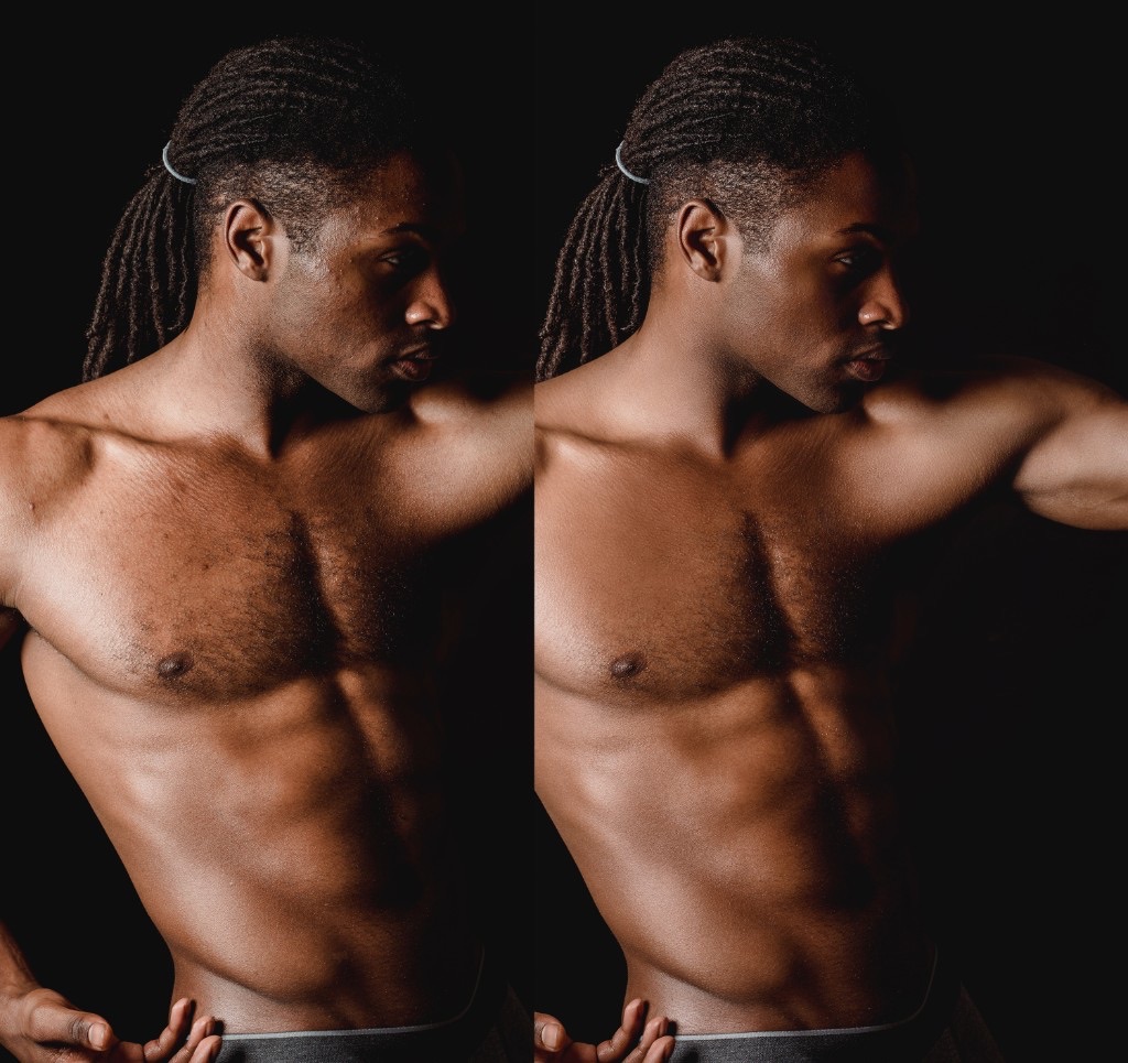 Retoque de pele: antes e depois
